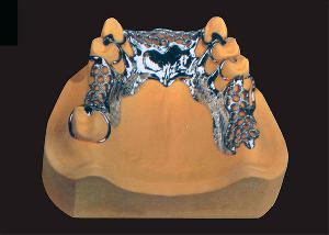 卡乃森钴铬高弹支架合金
