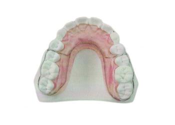 唇弓焊接式保持器