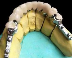 双球帽精密附件