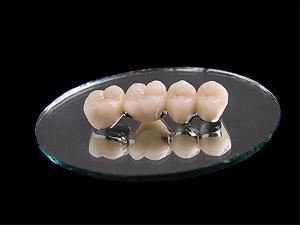 3D激光打印系列