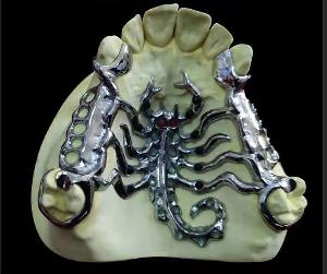 卡乃森高弹生物钴铬支架