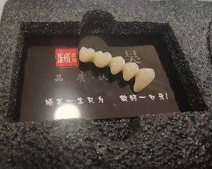 晶昊光纳覆义齿