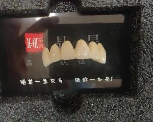 晶昊光纳覆义齿